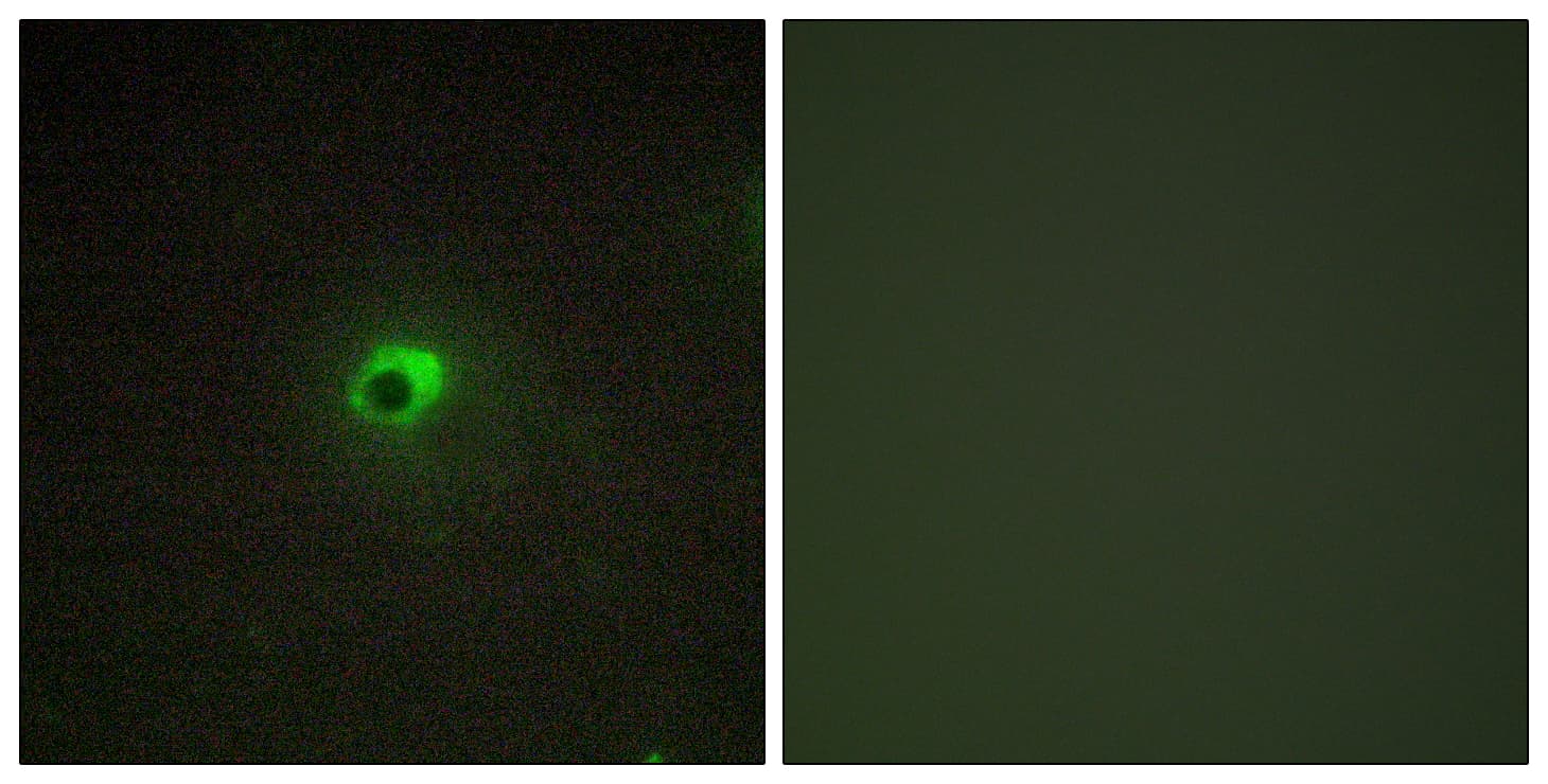 ACVR1C / ALK7 Antibody (aa201-250)