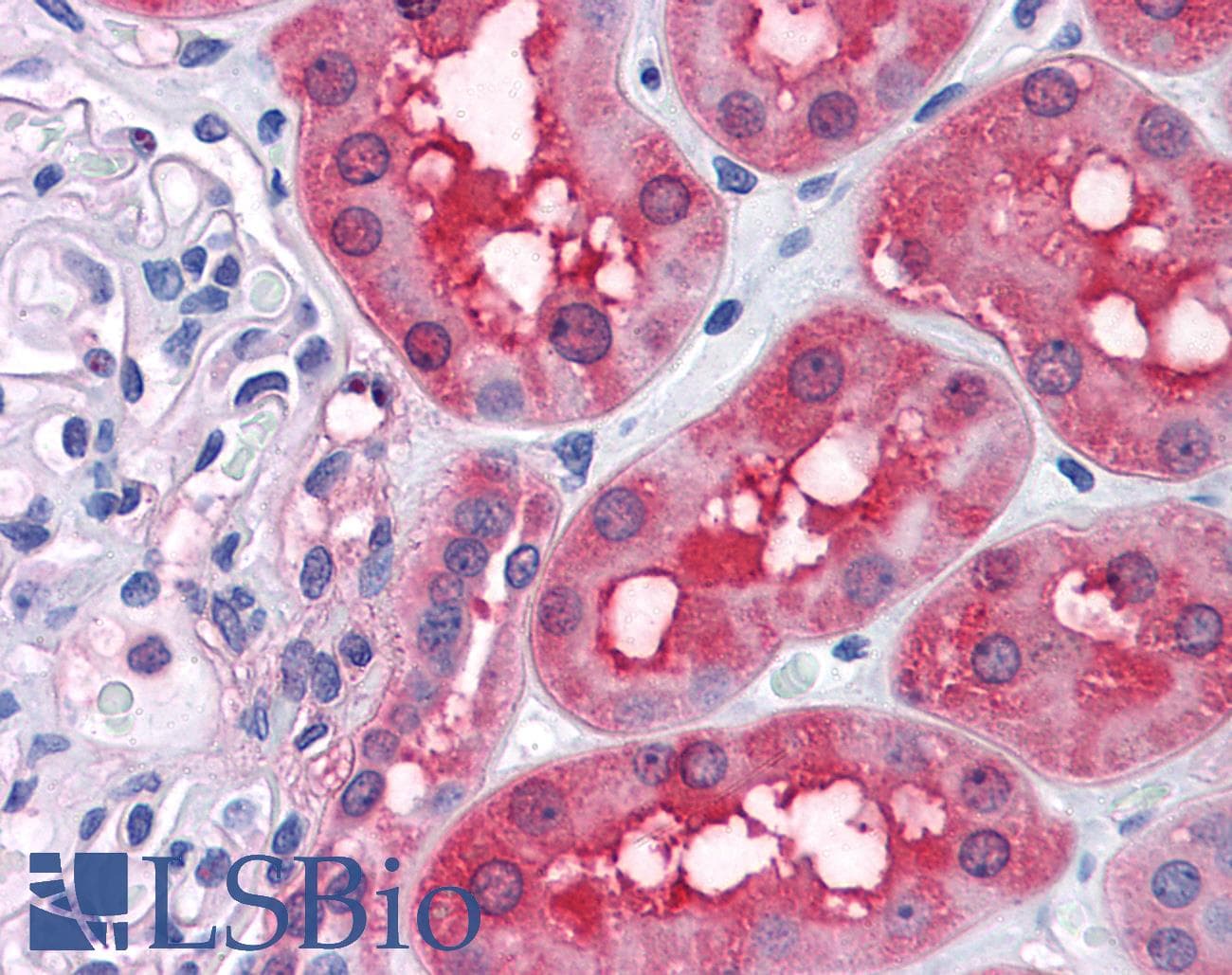 IHC-plus™ Monoclonal Mouse anti-Human RRM2 Antibody (clone 1E1, IHC, IF, WB)