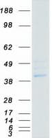 Human PPM1K Protein (Recombinant Myc-DDK (Flag))