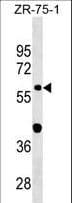 GDPD2 / GDE3 Antibody (aa305-334)