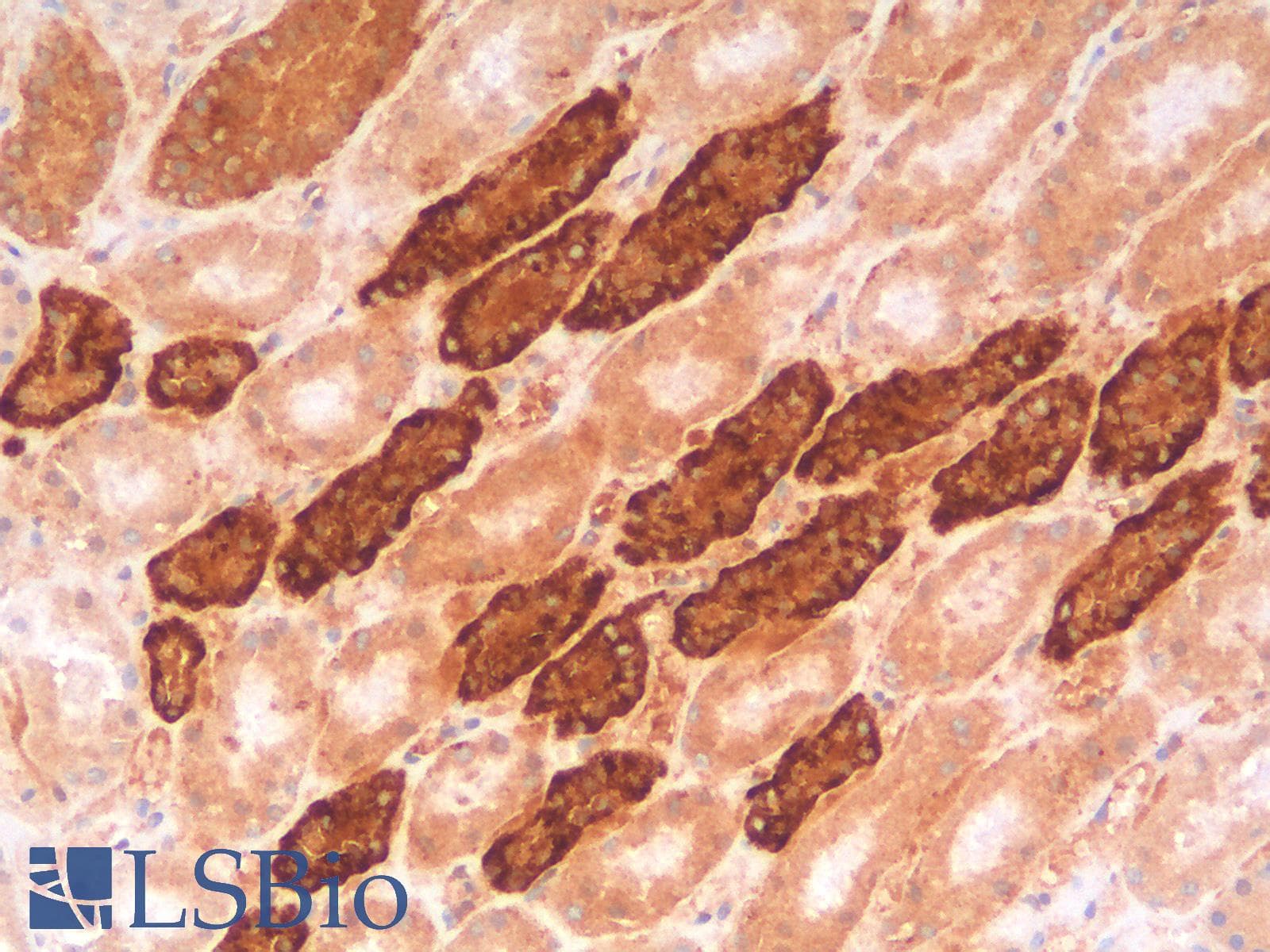 IHC-plus™ CDH16 / Cadherin 16 Antibody (clone CDH16/1532R)