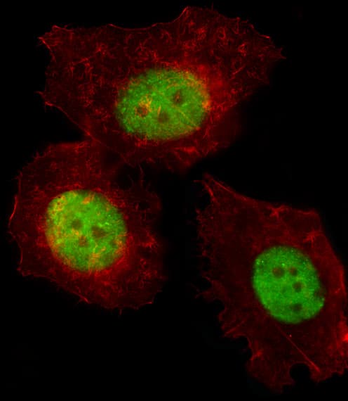 TRERF1 Antibody (aa1136-1164)