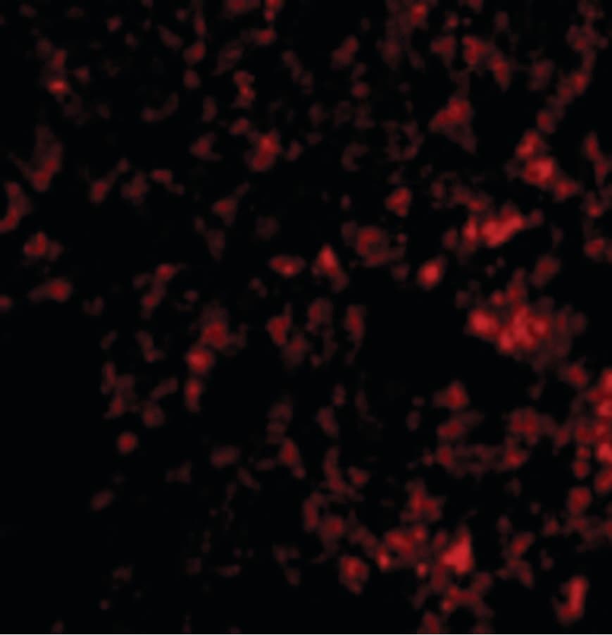 IHC-plus™ BLIMP1 / PRDM1 Antibody