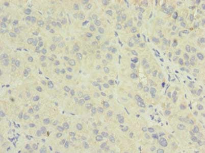 Polyclonal Rabbit anti-Human NME7 Antibody (aa1-150, IHC, WB)