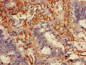 Polyclonal Rabbit anti-Human MLPH / Melanophilin Antibody (IHC, IF)