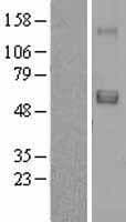 SRPX Protein (Over-Expression Lysate Myc-DDK (Flag))