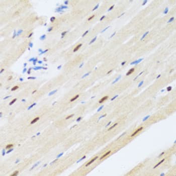MTA3 Antibody