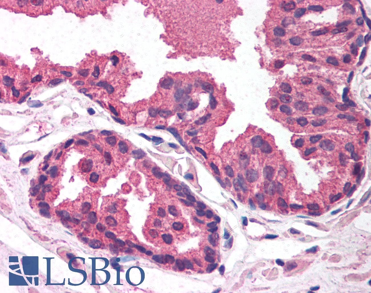 Polyclonal Rabbit anti-Human EGLN2 / PHD1 Antibody (aa58-107, IHC, WB)