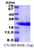 Human PTMA / Prothymosin Alpha Protein (Recombinant His)