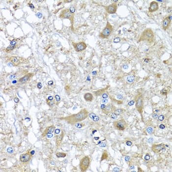 Alpha-1-Antichymotrypsin Antibody