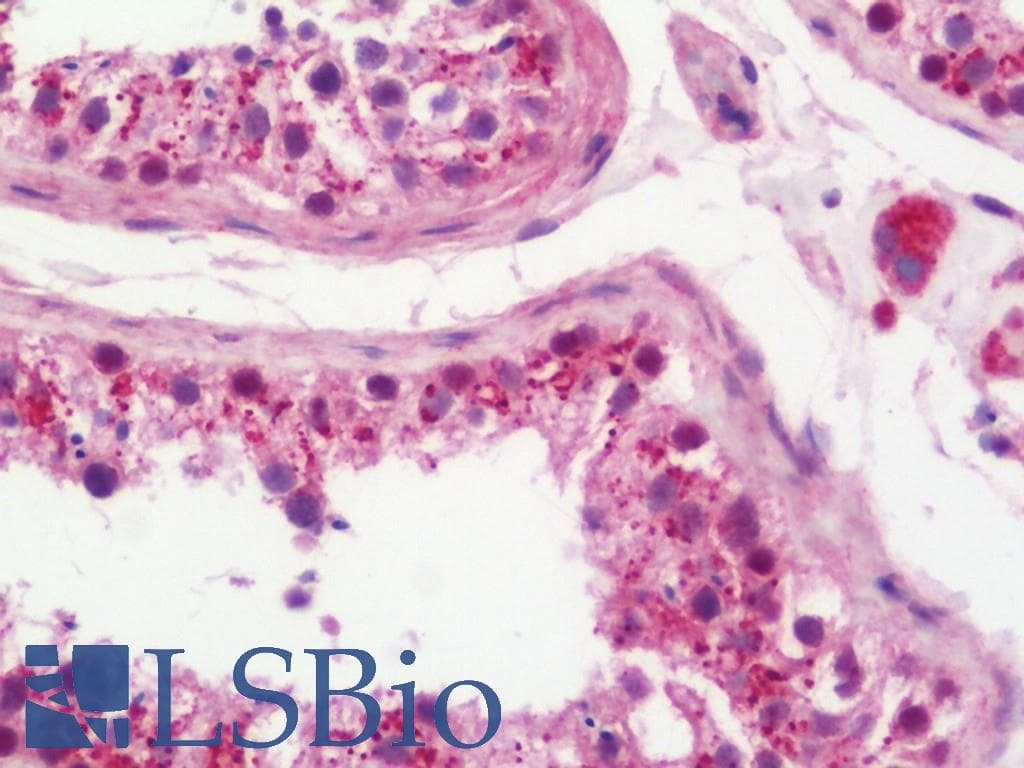 IHC-plus™ PRKCA / PKC-Alpha Antibody (aa1-250)