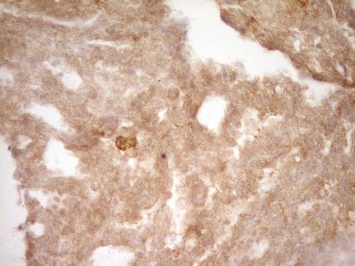 SLAMF7 / CRACC Antibody (clone OTI1F1)