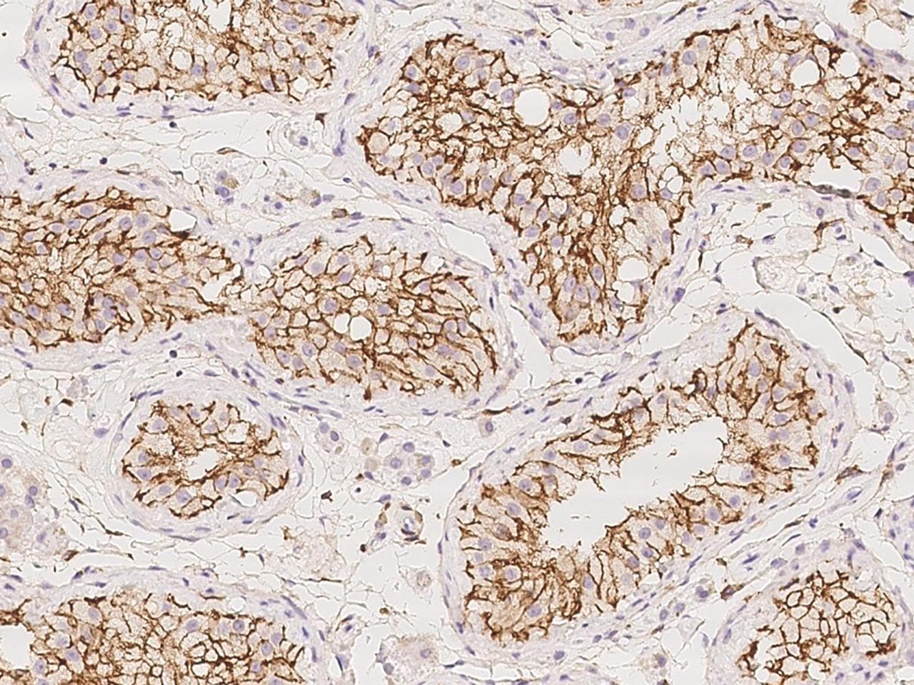 Polyclonal Rabbit anti-Human EPB41L3 Antibody (IHC)