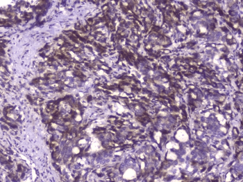Polyclonal Rabbit anti-Human Capicua / CIC Antibody (IHC)