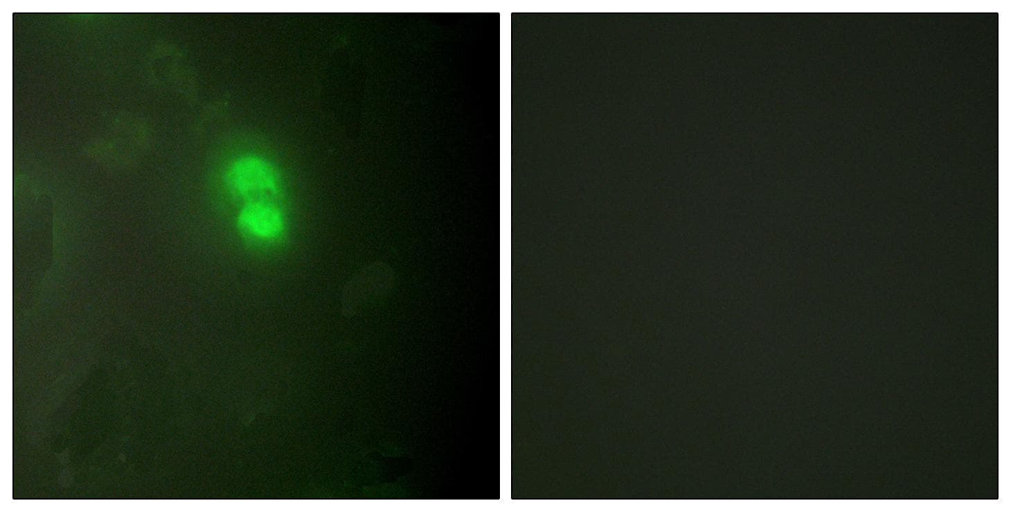 Polyclonal Rabbit anti-Human DKC1 / Dyskerin Antibody (IF, WB)