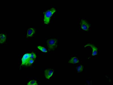 SLC5A5 / NIS Antibody