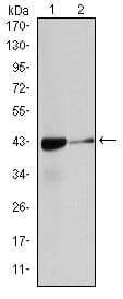 ACTA2 / Smooth Muscle Actin Antibody (clone 4F4)