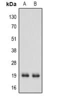 Polyclonal Rabbit anti-Human IFNA1 / Interferon Alpha 1 Antibody (C-Terminus, WB)