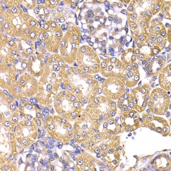 LAP3 Antibody (AP)