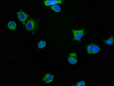 IHC-plus™ MAG Antibody (aa 25-516)