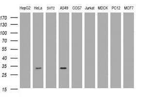 Monoclonal Mouse anti-Human ING2 Antibody (clone OTI4G10, WB)