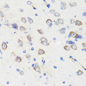 Polyclonal Rabbit anti-Human DLG1 / SAP97 Antibody (IHC, WB)