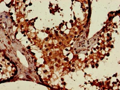 CSF2RA / CD116 Antibody (aa23-320)