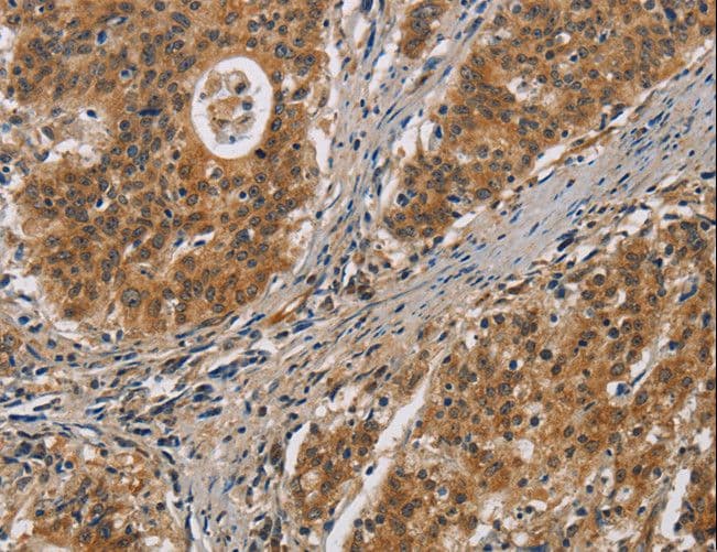 IL17D Antibody