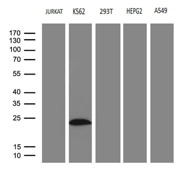 Monoclonal Mouse anti-Human MLC3F / MYL1 Antibody (clone OTI1H3, aa2-150, IHC, WB)