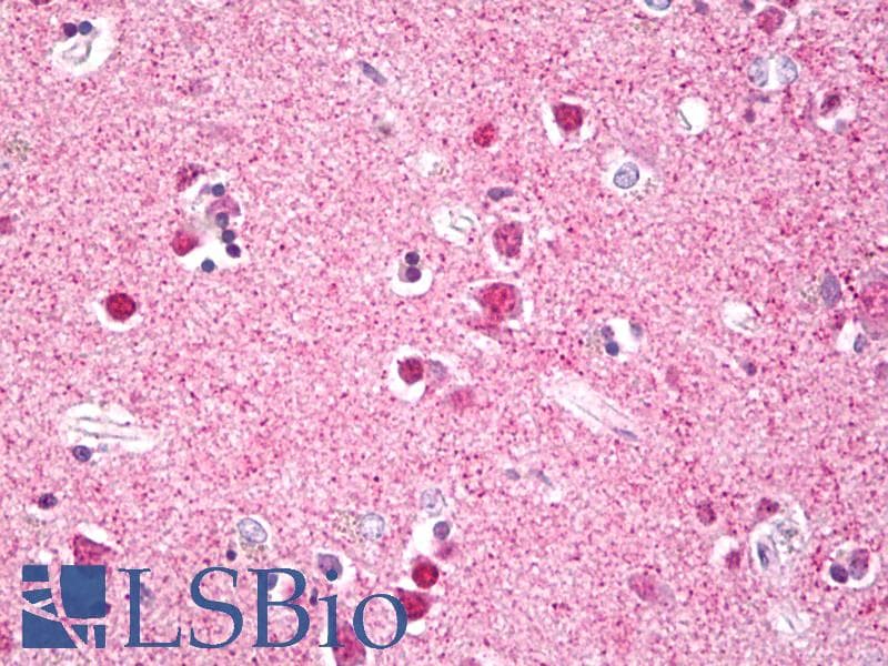 IHC-plus™ RPS6KA5 / MSK1 Antibody (aa551-600)
