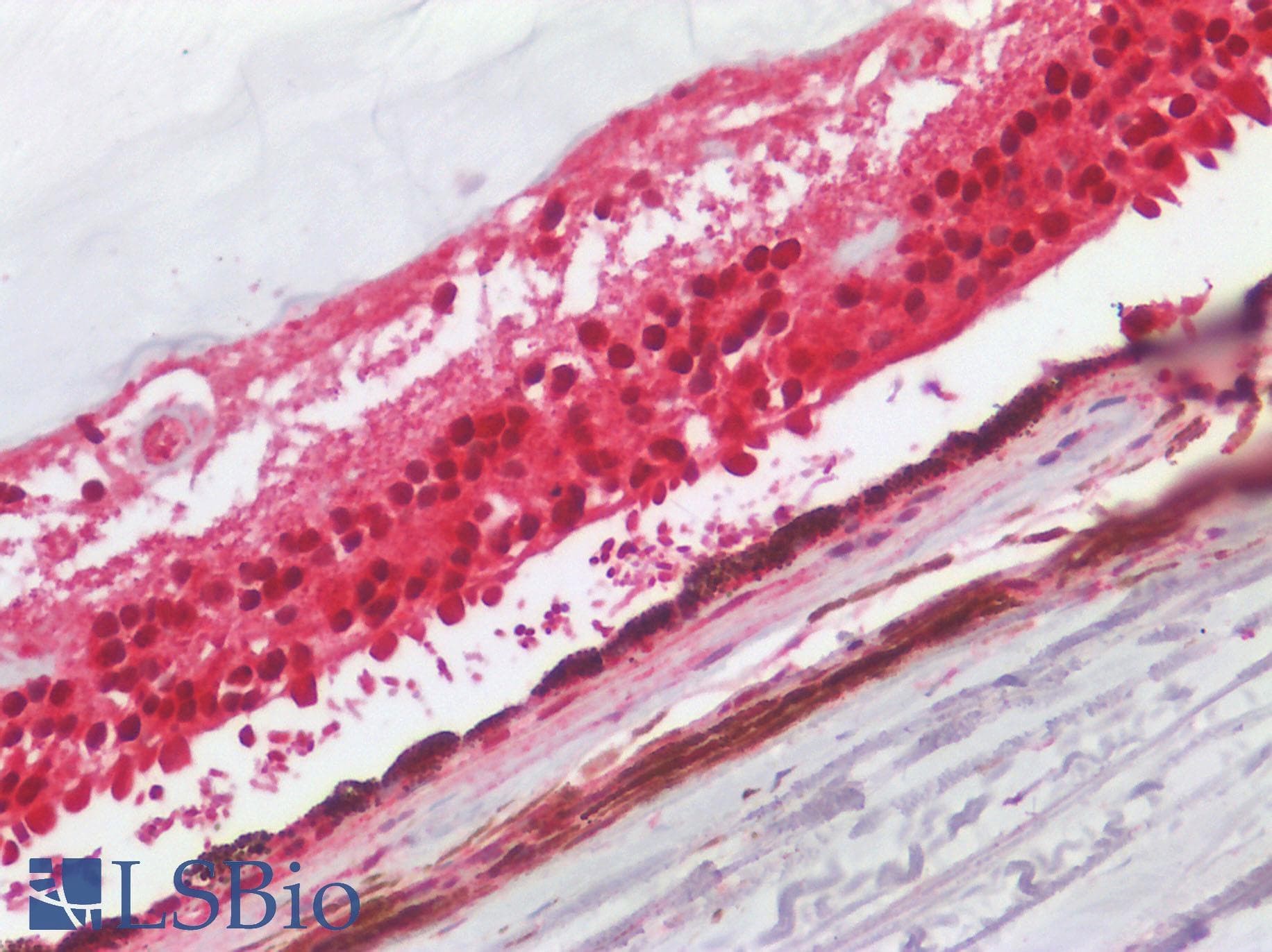 F2RL2 / PAR3 Antibody (Internal)