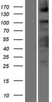 ASXL2 Protein (Over-Expression Lysate Myc-DDK (Flag))