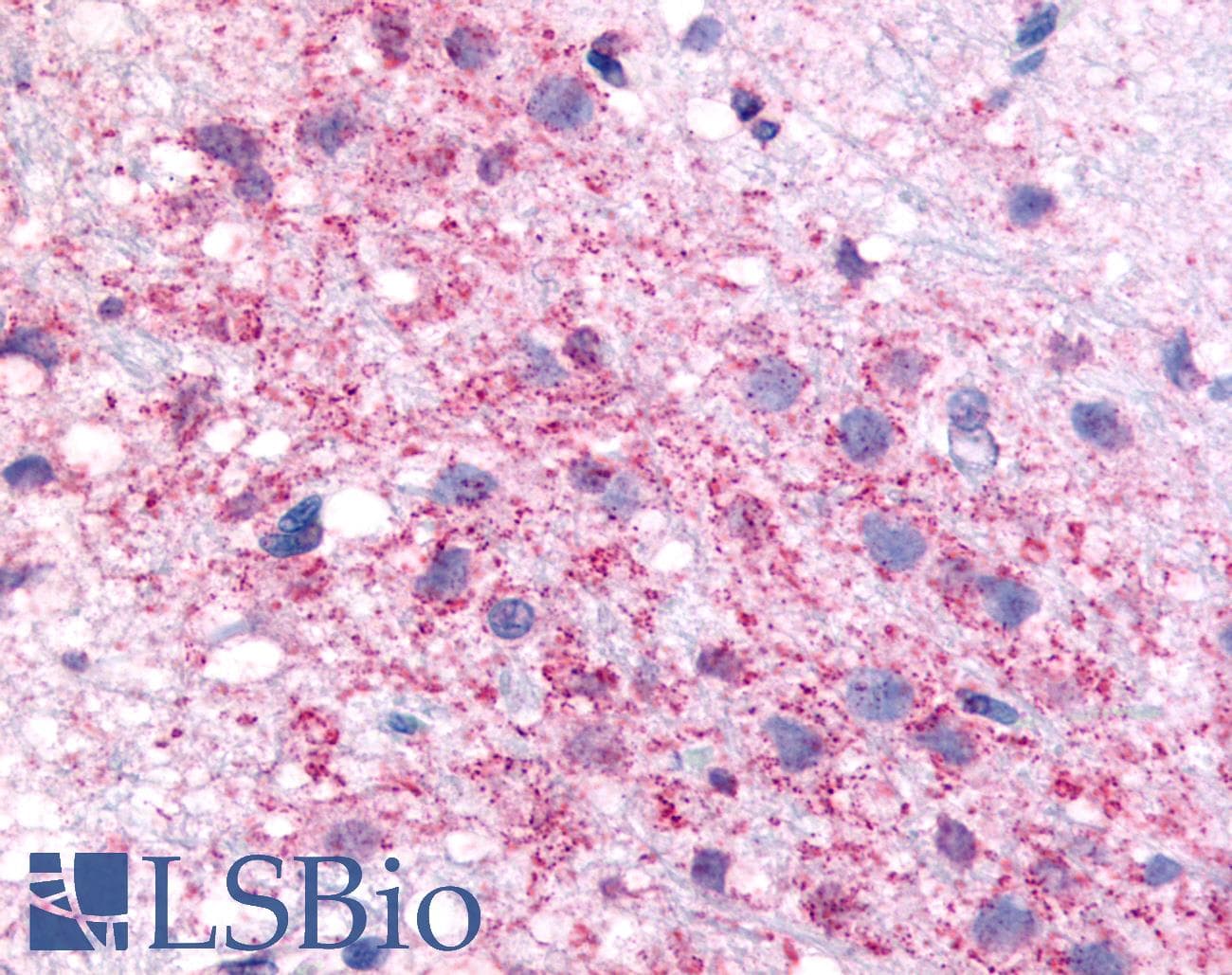 PathPlus™ CRFR1 / CRHR1 Antibody (N-Terminus)