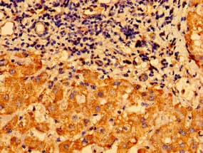 Polyclonal Rabbit anti-Human CHDH / CHD Antibody (IHC)