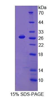 Human PD-L2 / PDCD1LG2 / CD273 Protein (Recombinant His-T7)