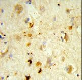 Polyclonal Rabbit anti-Human ITGBL1 Antibody (aa334-360, IHC, WB)