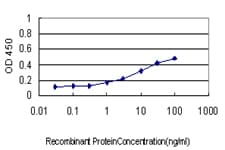 SYP / Synaptophysin Antibody (clone 3B3)