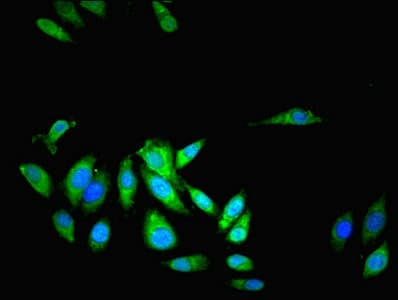 IHC-plus™ TRIP / LRRFIP1 Antibody