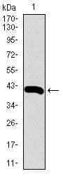 Monoclonal Mouse anti-Human RPL18A Antibody (clone 6G6G10, Amino Acid: 50-176, IHC, IF, WB)