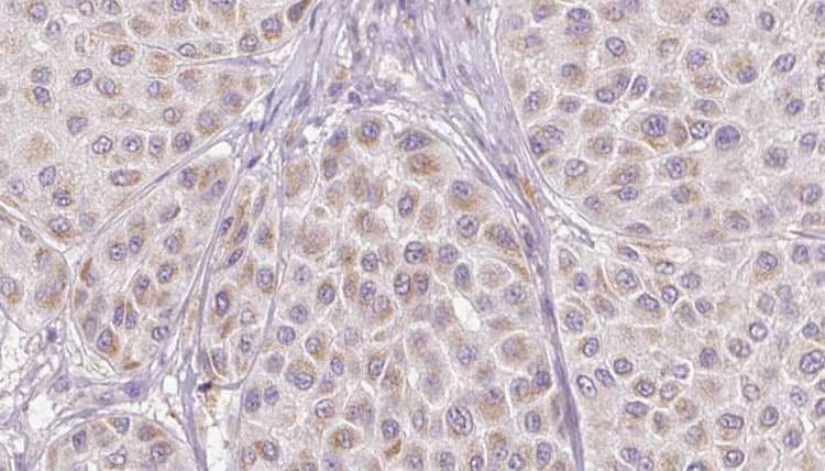 Antithrombin-III Antibody