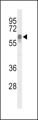Polyclonal Rabbit anti-Human ITPKC Antibody (aa89-117, IHC, WB)