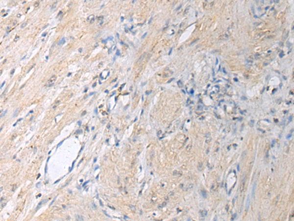 GNAI1 / Gi Antibody