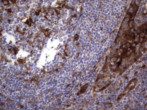 Monoclonal Mouse anti-Human LGALS3 / Galectin 3 Antibody (clone UMAB157, IHC, IF, WB)