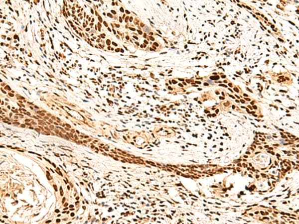 METTL1 Antibody