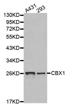 Polyclonal Rabbit anti-Human CBX1 / HP1 Beta Antibody (IHC, WB)