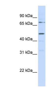 Polyclonal Rabbit anti-Human KREMEN1 / KREMEN-1 Antibody (aa108-157, WB)