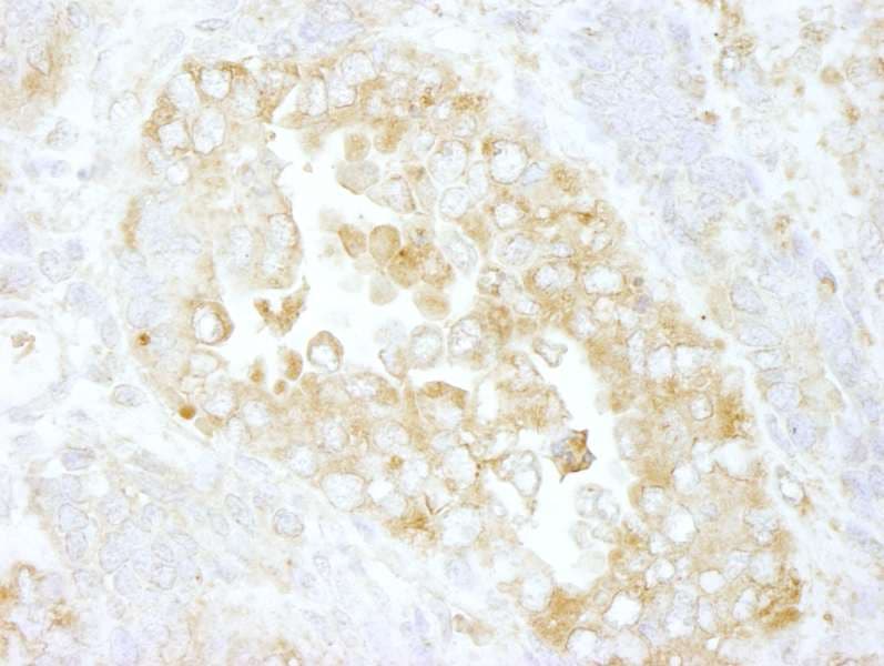 Polyclonal Rabbit anti-Human ARHGAP1 / CDC42GAP Antibody (aa1-50, IHC)