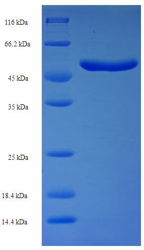 Human FANK1 Protein (Recombinant His-SUMO)