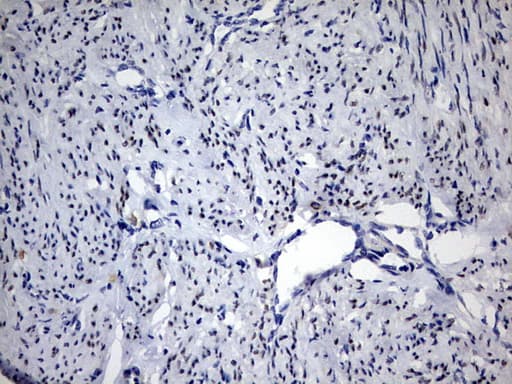 PR / Progesterone Receptor Antibody (aa1-298, clone OTI20A1)