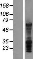 SLC7A8 / LAT2 Protein (Over-Expression Lysate Myc-DDK (Flag))